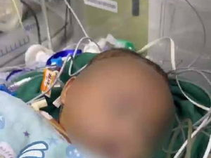 “多起心脏手术后患儿离世，医院管理层多人被免职引发关注”