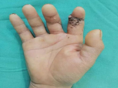 告别繁琐劳作：揭秘“废手指头”工作的替代之道